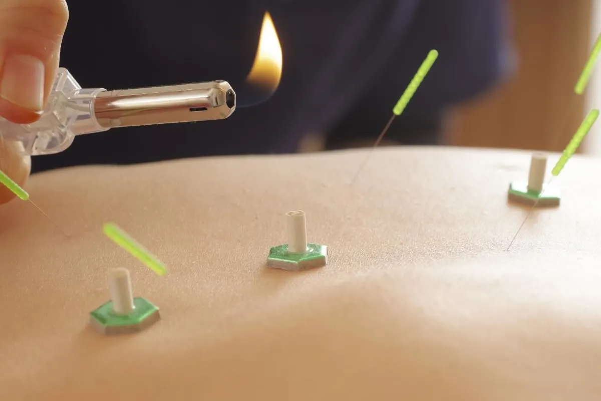 集客力を高める鍼灸院のMEO対策実践法について